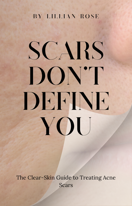 Scars Don’t Define You: The Clear-Skin Guide to Treating Acne Scars