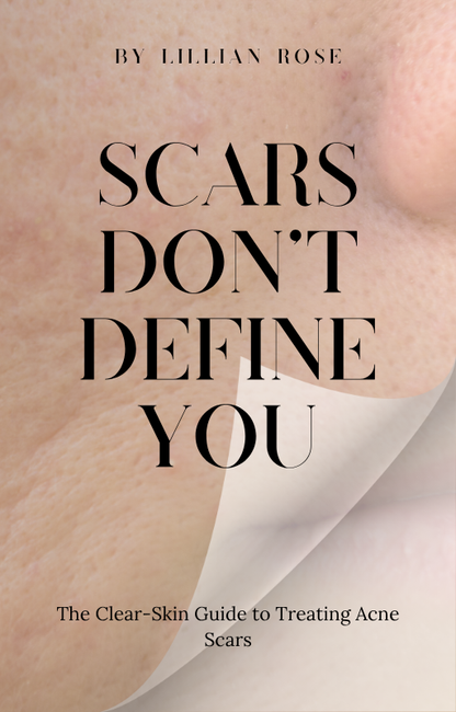 Scars Don’t Define You: The Clear-Skin Guide to Treating Acne Scars