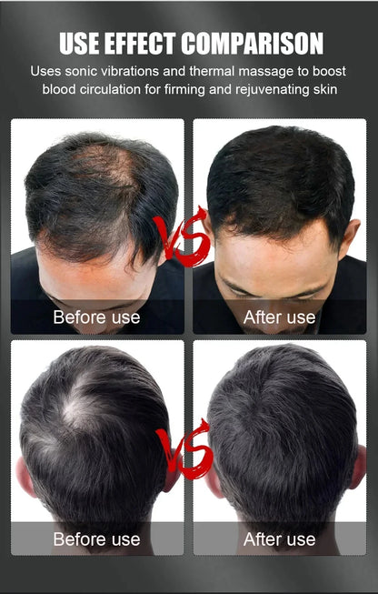 InfraGlow™ 96-LED Red Light Therapy Hair Growth Cap