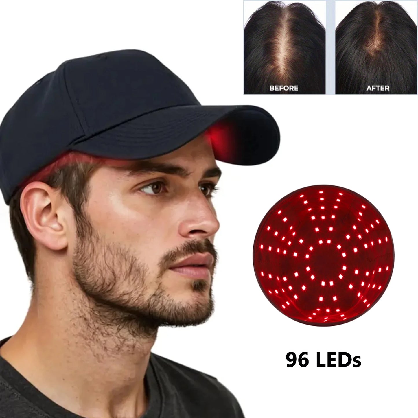 InfraGlow™ 96-LED Red Light Therapy Hair Growth Cap